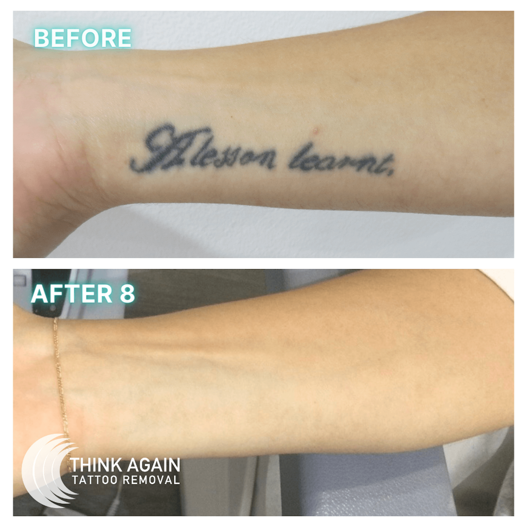 Harrisburg Tattoo Removal - Beyond Brows Permanet Cosmetics